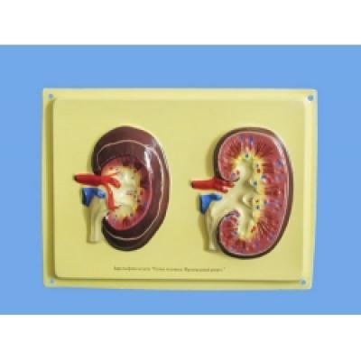  Structure of the Kidney, Bas Relief Model